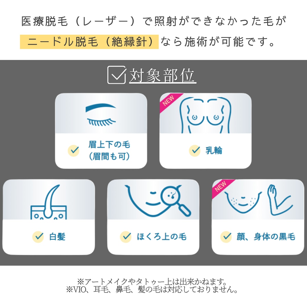 施術対象部位はこちら